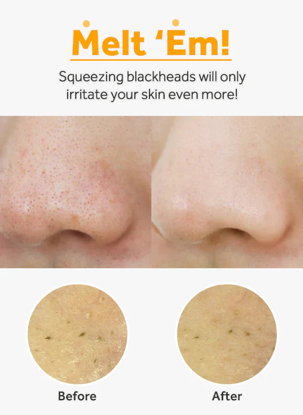 Pure Cleansing Oil 6.7 fl oz - Blackhead Melting, Daily Makeup Removal with Argan Oil