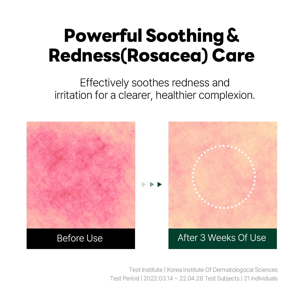 1025 DOKDO Ampoule 45g - Hydrating, Soothing, Instant nourishing