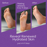 Aesta 3-Step Foot Peel Mask Treatment Kit for Dry Cracked Feet, Callus Remover, Baby Soft Feet, Vegan Foot Care