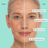 Azelaic Acid Soothing Toner Pads for Redness Relief & Radiant Skin, tone evening, blemish care, calming hydration