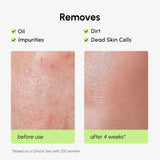 Daily Glow Exfoliating Toner with AHA BHA for Smooth Radiant Skin, gentle resurfacing, pore refining, clarity boost