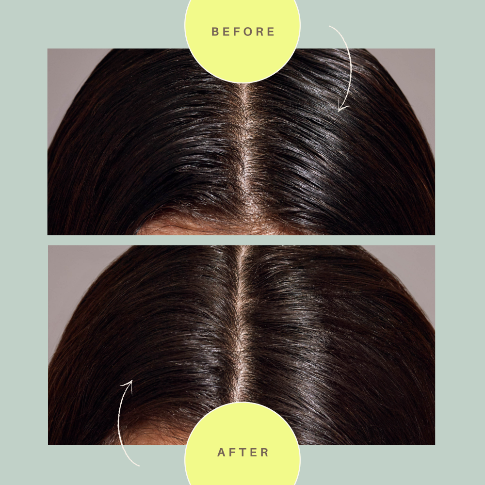 Day After™ Renew & Refresh Brush – oil control, deodorizing, scalp-friendly