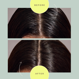 Day After™ Renew & Refresh Brush – oil control, deodorizing, scalp-friendly