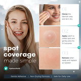 Rescue Patch Hydrocolloid Breakout Dots – acne patches, blemish care, invisible spot covers
