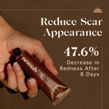 Restorative Scar Treatment - Scar Healing, Regenerative