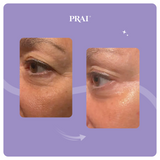 Ageless Eye Tight Uplift Serum – Instant Lifting Eye Treatment, Brow & Lid Firming Serum, Smoothing Under-Eye Care-eye lifting, brow firming, wrinkle smoothing