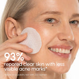 Witch Hazel Clearing Pads for Blemish Control & Gentle Exfoliation, pore refining, oil balancing, skin soothing